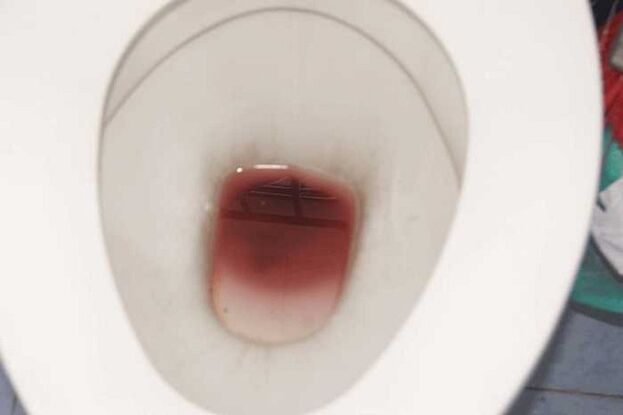 Aparecen manchas cuando los hombres están excitados.