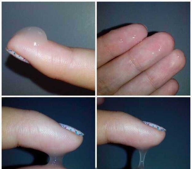 Preeyacular durante la excitación sexual masculina.